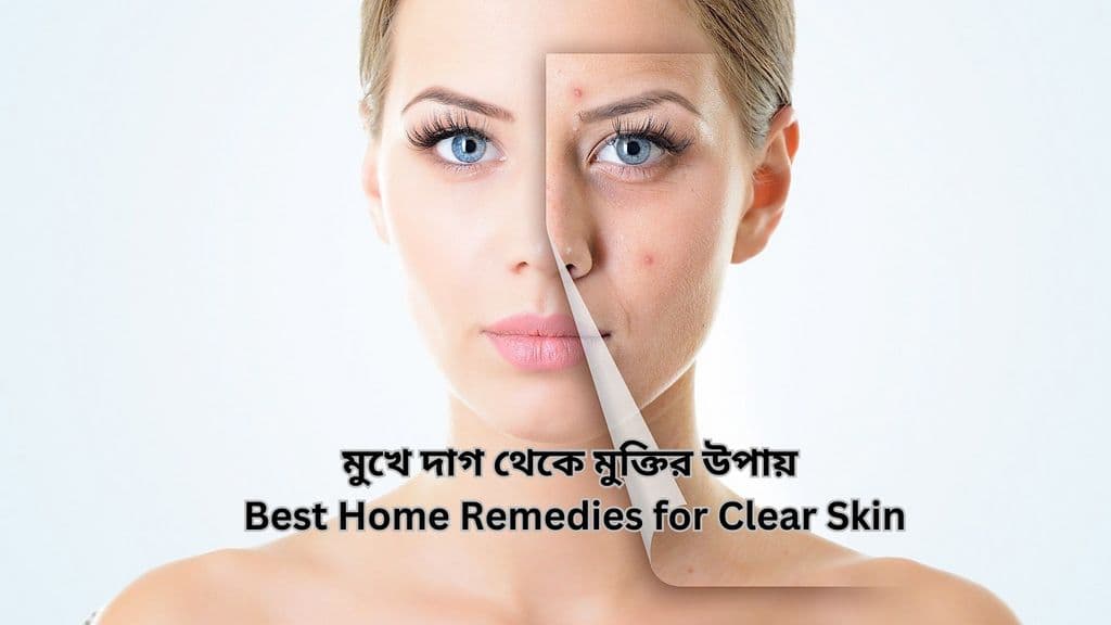 মুখে দাগ থেকে মুক্তির উপায় | Best Home Remedies for Clear Skin In Bengali